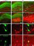 Kit Components. CAMK2 alpha Kinase Enzyme System. Turn Key Enzyme Substrates 5x Reaction Buffer A. Kinase Activators Ca2+/Calmodulin