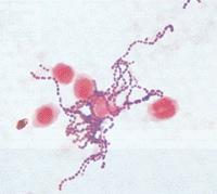 STREPTOKOKLAR Çocukluk çağının en sık bakteriyel enfeksiyon etkeni Grup A ɓeta hemolitik Streptokoklar-GAS-