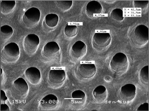 The collagen fibrils are dispersed in planes basically perpendicular to the lumens[43]. The tubules contain fluid and cellular structures[44].