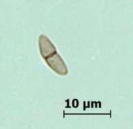 1-Septalı askosporlar (Ascomycetes) Cins düzeyinde ayırt edilemeyen, hyalin veya renkli, tek septuma