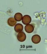 Ustilago (Pers.) Roussel (Basidiomycetes) Birçok çayır, çimen ve tahıllar üzerinde parazit olarak yaşarlar.