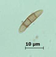 Çok septalı askosporlar (Ascomycetes) Bitki patojeni veya saprofit olarak yaşayan, Askomisetes şubesine bağlı ve birden