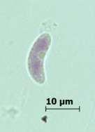 Septasız askosporlar (Ascomycetes) Bitki patojeni veya saprofit olarak yaşayan, Askomisetes şubesine bağlı ve septasız sporlara sahip olan, cins düzeyinde
