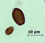 Elipsoidal bazidiosporlar (Basidiomycetes) Bitki artıkları üzerinde saprofit veya bitkiler üzerinde