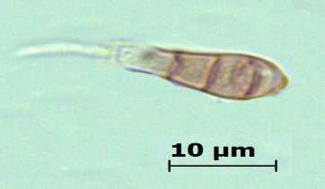 Exosporiella P.Karst. (Ascomycetes) Nemli ortamlarda ve mantarlar üzerinde saprofit veya parazit olarak gelişir.