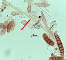 Sporidesmium Link ex Fr. (Ascomycetes) Nemli ortamlarda çürümekte olan bitki artıkları ve çöpler üzerinde saprofit olarak veya birçok bitki üzerinde patojen olarak gelişir.