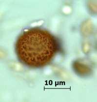 Periconia Tode (Ascomycetes) Ot artıkları otsu gövdeler, yaprak artıkları üzerinde saprofit veya bazı otsu birki kökleri