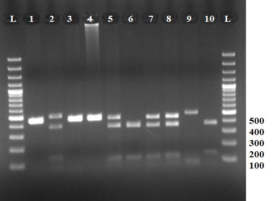 25 bireylerde; 396 ve 116 bç uzunluğunda iki bant genotipleri gözlemlenmiştir (Şekil 4.1.2.). Şekil 4.1.2. 512 bç lik PCR ürünlernin TaqI restiksiyon endonükleaz enzim kesim sonrası RFLP görüntüsü