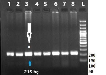 26 Şekil 4.2.1. STAT5A-AvaI polimorfizmi için yapılan PCR işlemi sonunda elde edilen 215 pç lik ürünler. L: 50 bç lik DNA merdiveni; a: 215 bç lik PCR ürününün bant görüntüsü.