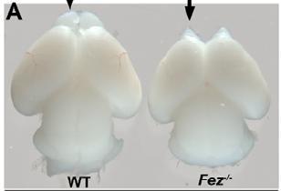 Bu fatal karın distansiyonunun FEZF1 geninin gastrik kanserlerde overeksprese olması ile ilişkili olabileceği düşünülmüştür (Song ve ark, 2009; Song ve ark, 2011). A B Şekil 4.18.