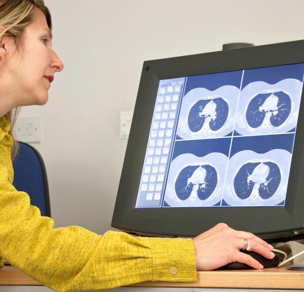 Bir röntgen uzmanı, yandaki bir odadan makineyi çalıştırarak gerekli olan resimleri çeker. Göğüs BT taraması akciğer kanserini nasıl tespit eder?