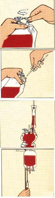 SAKLAMA 1. Tam kan ve/veya kırmızı kan hücreleri saklanacaksa, i. Tam kan veya eritrositleri 1-6 C de kan saklama dolabına koyunuz. 2. Trombosit saklanacaksa, i.