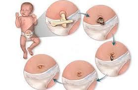 GÖBEK BAKIMI VE KONTROLÜ Göbek bebek bezinin dışında kalmalıdır Ve kuru tutulmalıdır. Göbek 7-14 gün içerisinde kuruyarak düşer.