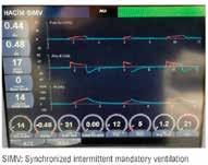 Only spontaneous breathing pressure provides CPAP (Continue Positive airway pressure), ie PEEP or PEEP + PSV support. If there is no spontaneous breathing, it does not provide support.