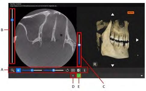 3D Kalite Kontrol Penceresi Önemli: Kalite kontrol arayüzünde görüntülenen görüntü yalnızca bilgi amaçlıdır. Tanı koyma amacıyla KULLANMAYIN.