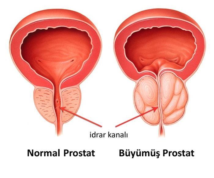 Günde 0,5.- 2 ml prostat salgısı üretilir. Salgılanımı testosteron ile idare edilir. Salgının alkali karakteri, vaginadaki asit ortamın nötralizasyonuna katkıda bulunarak spermiumları korur.