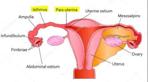 Isthmus Tuba Uterinae: İsthmus yaklaşık 2.5 cm uzunluğunda, uterusa yakın en dar bölümdür. Pars Uterina: (pars intramuralis) Tuba uterinanın, uterus duvarı içinde kalan en dar lümenli bölümüdür.