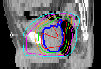 izleme (median 7 yıl; up to 10