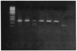 İçermeyen kontrol, M; 50 bç lik DNA Marker ve (1-13) Over CA hasta DNA ürünleri M 14 15