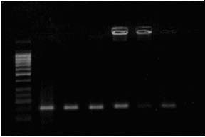 kontrol, M; 50 bç lik DNA Marker ve (1-13) over CA hasta DNA ürünleri M 14 15 16 17 18 19 20 (-)
