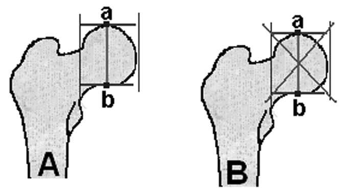 Translasyon ve translasyon-angulasyon deformiteleri Ýki bölümden oluþan bu yazýnýn ilk bölümünde frontal ve sagital plan deformitelerini inceleyeceðiz. A.
