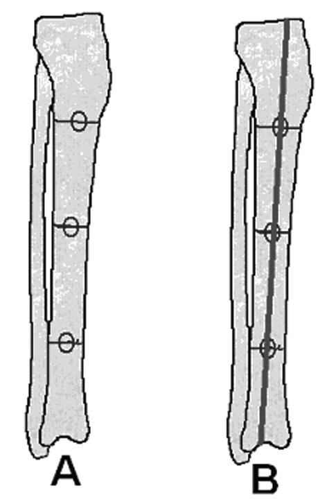 Alt ekstremitedeki üç büyük eklem olan kalça, diz ve ayak bileðinin her biri sagital planda hareket ederek kötü dizilimi telafi edebilir.
