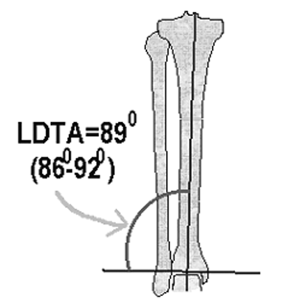 Femur baþý merkezi, femur distal eklem yüzü merkezi ile birleþtirilerek femur mekanik ekseni çizilir.