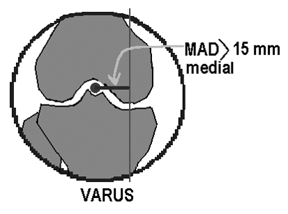 Bunun için Medial Proksimal Tibial Açý (MPTA) ölçülür. Tibia proksimal eklem yüzü merkezi, tibia distal eklem yüzü merkezi ile birleþtirilerek tibia mekanik ekseni çizilir.