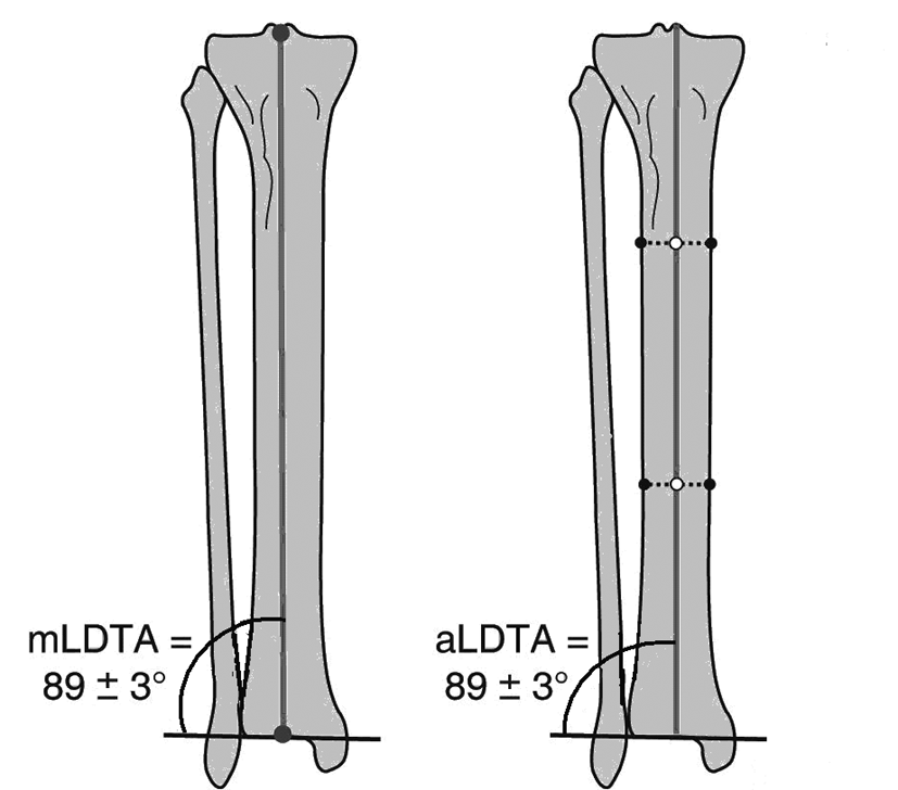 Femur Mekanik Ekseni Sagital planda femur mekanik eksenini çizmek için, kalça ve diz rotasyon merkezini bulmak gereklidir (Þekil 36).