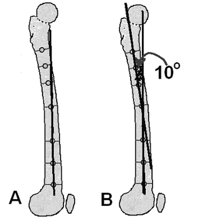 Þekil 43 a, b: Sagital planda tibia oryantasyon hatlarý; a: Proksimal tibia; b: Distal tibia.