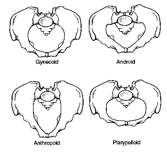Resim 5: Pelvis tipleri a) Gynecoid pelvis: Klasik kadın tipi pelvistir. Kadınların % 40 kadarında bulunur. Pelvis girimi yuvarlağa yakın ovoiddir. Girimin transvers çapı ön-arka çapdan hafif uzundur.