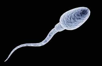 13 Resim 1. Sperm başının oval şekli görülmektedir.(16) Normal al İçerik Azalması al İçerik Total Kaybı al Membran Anomalisi Şekil 3. Sperm baş defektleri.