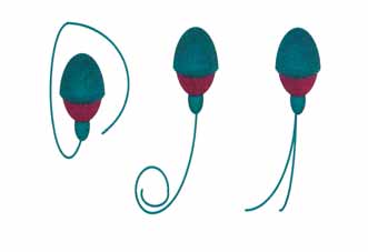 14 Dag Defekti Coiled Tail Duplikasyon Şekil 6. Sperme ait kuyruk defektleri görülmektedir.(18) değerlendirmelerin ön plana çıktığı ve sınır değeri olarak çoğunlukla %4 ün alındığı anlaşılmaktadır.
