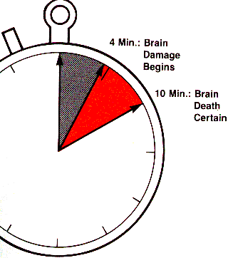 0-1 dakika prognoz iyi, kardiyak irritabilite olabilir 0-4 dakika Geri dönüşsüz beyin hasarı beklenmez 4-6