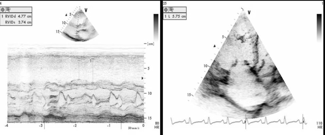 28 Eko ve diğer görüntülemeler Anadolu Kardiyol Derg Pulmoner arteriyel hipertansiyonda kullanılan ekokardiyografi ve diğer görüntüleme yöntemleri 1) Ekokardiyografi Pulmoner arter basıncının