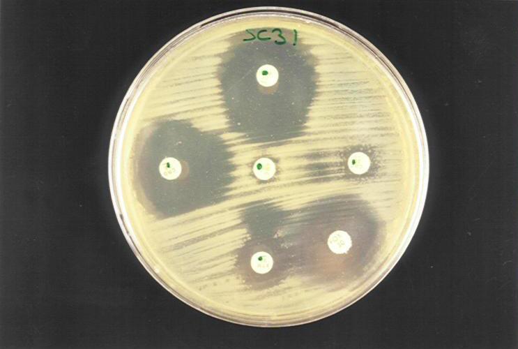 coli Verilen antibiyogram: Sefepim, sefotaksim, aztreonam, seftazidim, diğer