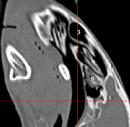 Şekil 3.14. Sinus paranasales in sagittal MDBT görüntüsü.