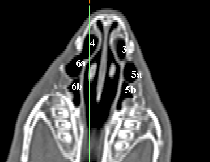 Şekil 3.17. Sinus paranasales in coronal MDBT görüntüsü.