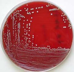 Kültürde Mikroorganizma Üremesi S. pneumoniae S.