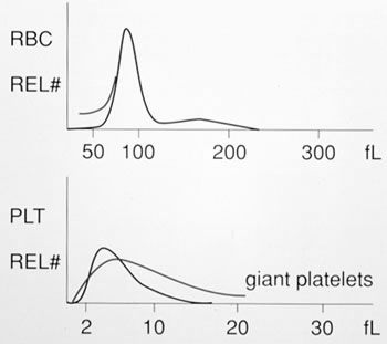 Plt Histogram Normal platelet histogram (2-20 fl).