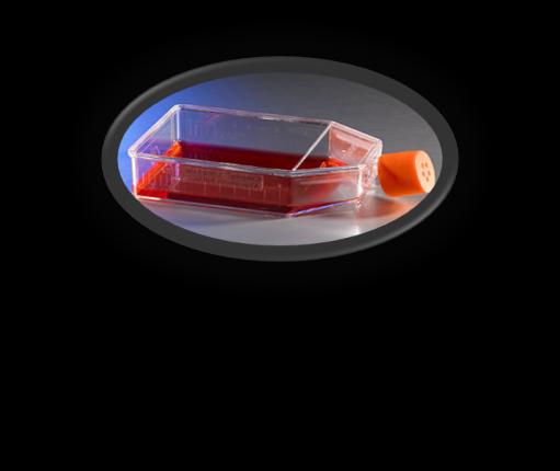 CAIX Ekspresyonu Real time PCR (mrna