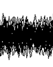 What is visible in the EEG?