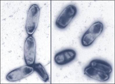 Kapsül Escherichia coli, Klebsiella pneumoniae ve Haemophilus influenzae gibi gram negatif bakterilerde daha yaygın olarak bulunur.
