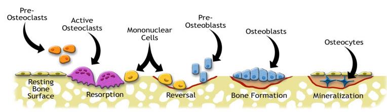 KEMİK Kemik Yeniden Modellenmesi Yeniden Modellenme daha çok Trabeküler kemiklerde olmak üzere tüm kemik dokularda IL-1 Öncü Osteoklastlar Aktif Osteoklastlar Mononükleer Hücreler Öncü