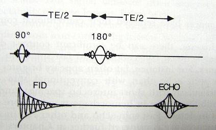 TR (time to repeat): 90 derece pulslar arasındaki zaman (ms) TE