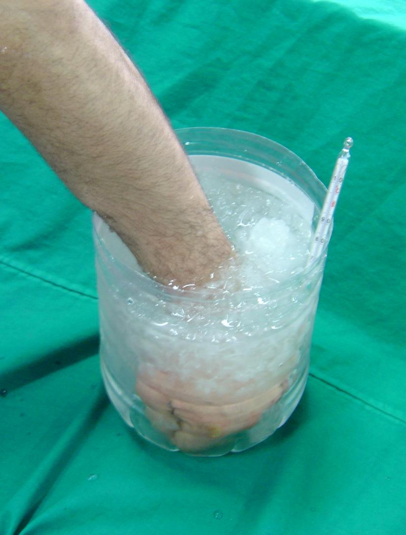 Kayıt prosedürü Soğuk stresinin uygulanması Soğuk stresi deneğin bir elinin kayıt süresince 10 o C buzlu