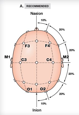 EEG -Önerilen a. F4-M1 b. C4-M1 c.