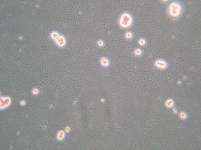 BULGULAR (MCF-7 ve Apoptoz) 0.