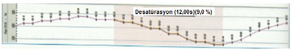 Genlik(mV) Genlik(mV) 1 0.5 0-0.5 denilmektedir [17]. Şekil 2.1 de hipopne durumundaki hava akımı ve SaO2 deki değişimler gösterilmiştir.