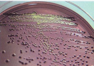 Resim 4-2 E. coli EMB Agar Çalışmamız sırasında tespit edilen bir diğer grup nozokomiyal enfeksiyon etkeni Enterobacter spp. dir.